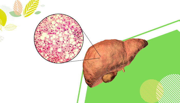 Identifying Fatty Liver Symptoms