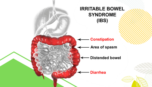 IBS Treatment: Causes, Symptoms, and Medications