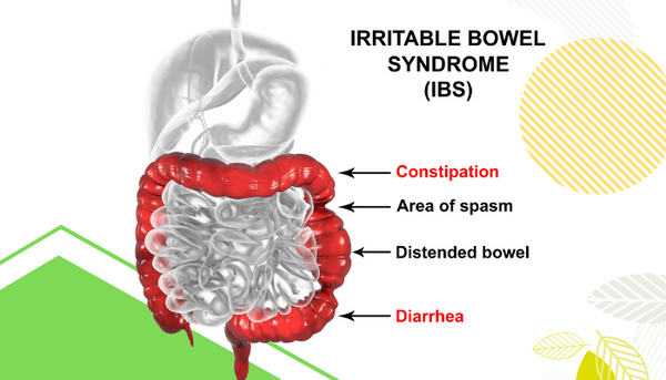 IBS Treatment: Causes, Symptoms, and Medications - Organic Nutrition ...